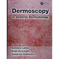 Dermoscopy in General Dermatology