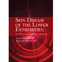 Skin Disease of the Lower Extremities: A Photographic Guide (English Edition)
