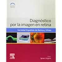 Diagn&oacute;stico Por La Imagen En Retina
