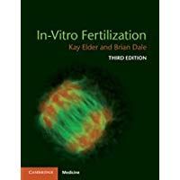 In-Vitro Fertilization