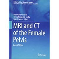 MRI and CT of the Female Pelvis (Medical Radiology)