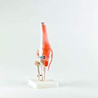 Patterson - Articulaci&oacute;n para rodilla