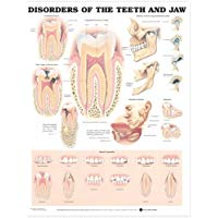Disorders of the Teeth and Jaw Anatomical Chart