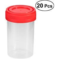 UEETEK Vaso para muestras, 20 piezas Pr&aacute;ctico envase de orina de pl&aacute;stico de 60 ml EO est&eacute;ril sin etiqueta para uso m&eacute;dico de laboratorio (color aleatorio)