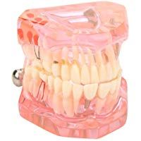 Akozon Modelo dental de la ense&ntilde;anza, los dientes del adulto del dentista del modelo del cuidado dental, Desmontable(Rosa)