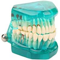 Akozon Modelo dental de la ense&ntilde;anza, los dientes del adulto del dentista del modelo del cuidado dental, Desmontable(Verde)